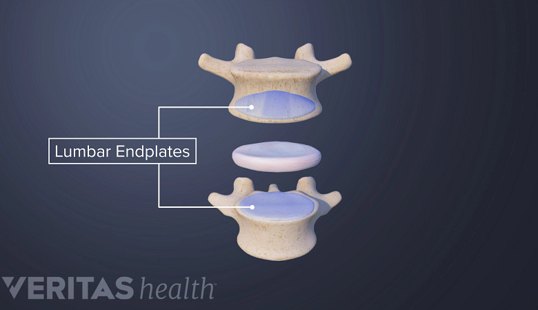 Lumbar endplates between two vertebra