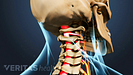 Posterior view of structural Anatomy of the neck with spinal cord highlighted