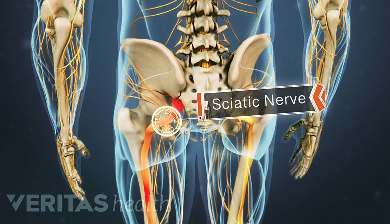 Sciatic nerve running down the leg.