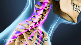 Wephysio MFC - Stiff neck. 🔵 What is stiff neck? 🔹 A stiff neck