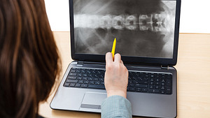 Spine X-ray on laptop computer