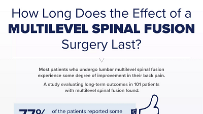 How Long Does the Effect of a Multilevel Spinal Fusion Surgery Last?