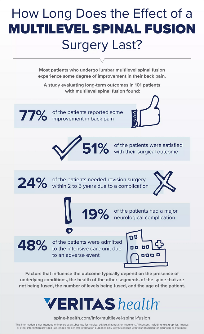 How Long Does the Effect of a Multilevel Spinal Fusion Surgery Last?