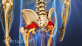 Posterior view of the pelvis showing piriformis syndrome.