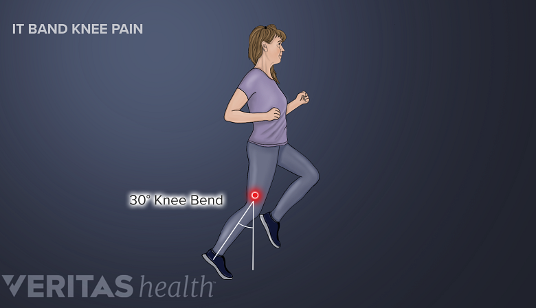 Illustration showing a woman jogging with her knee bent at 30 degree angle.