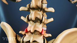 Posterior view of the spine with facet joints highlighted