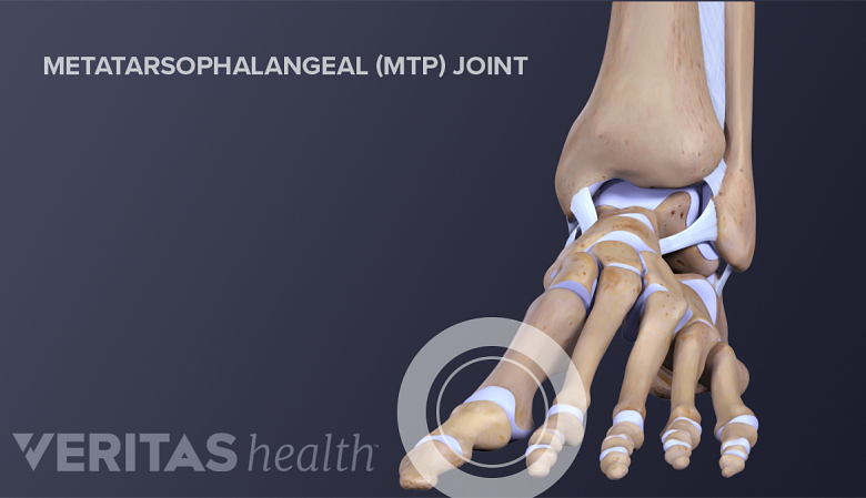 Illustration showing anatomy of feet labelling metatarsophallengeal joint.