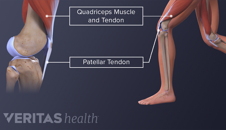 Knee anatomy showing the quadriceps muscle and tendon and patellar tendon