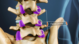 Posterior view of the lumbar spine with facet joints highlighted.