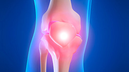 Skeletal view of the knee showing pain in the joint.