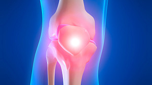 Skeletal view of the knee showing pain in the joint.