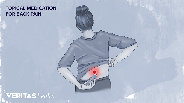An illustration showing topical medication application for lower back pain.