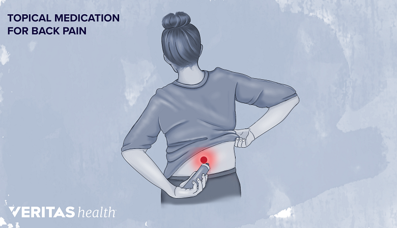 Illustration showing a woman applying topical medication on her back and a red dot in the low back.