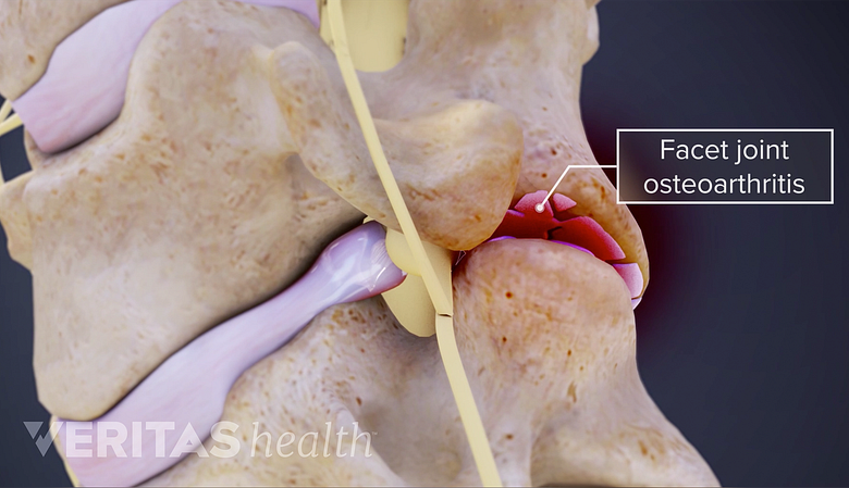 3D image of cervical spine.