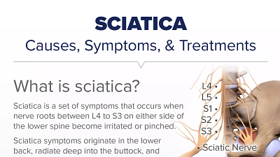 Understanding Sciatica: A Comprehensive Guide to Symptoms, Causes, and  Treatments - Total Spine and Orthopedics
