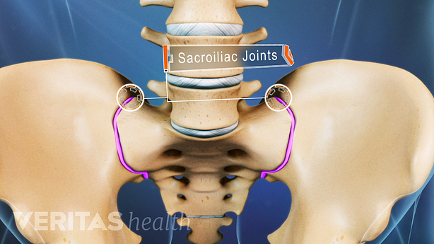 Anterior view of the pelvis with the SI joints highlighted.
