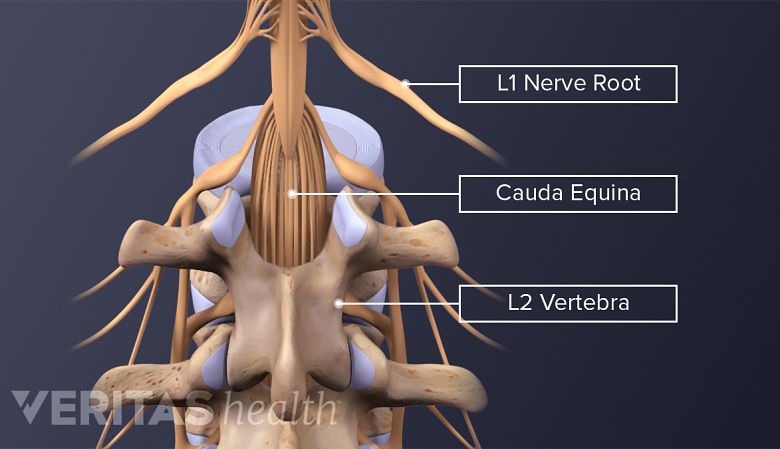插图显示脊柱的caudaequina神经