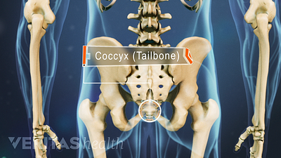 Posterior skeletal view highlighting the Coccyx (tailbone)