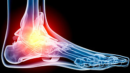 Ankle Sprain and Strain Signs and Symptoms