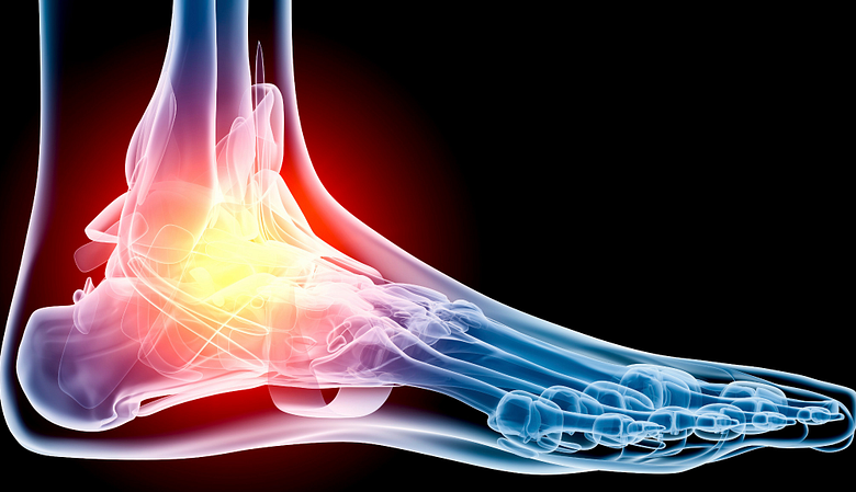 X-ray of the foot and ankle.