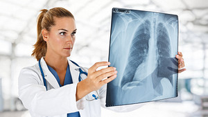Doctor examining an X-ray of a patient&#039;s lungs and spine.