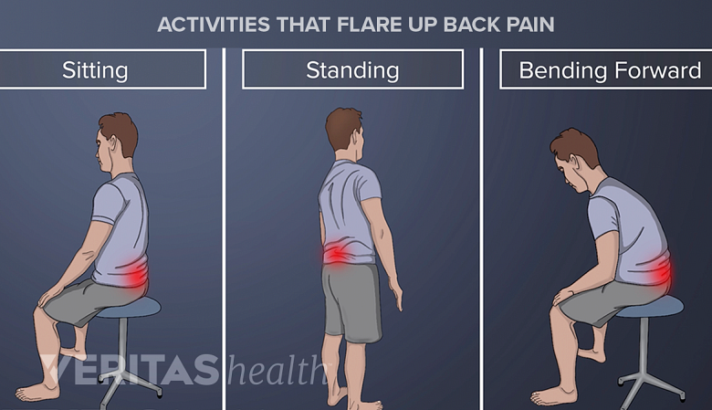 Activities that increase back pain, pinched nerve pain, and herniated disc pain