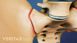 Close up illustration of hip bones, with sacroilliac joint pain areas highlighted in red