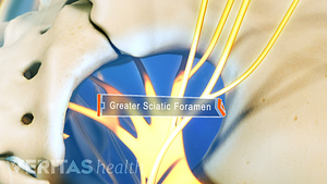 Posterior view of the greater sciatic foramen.