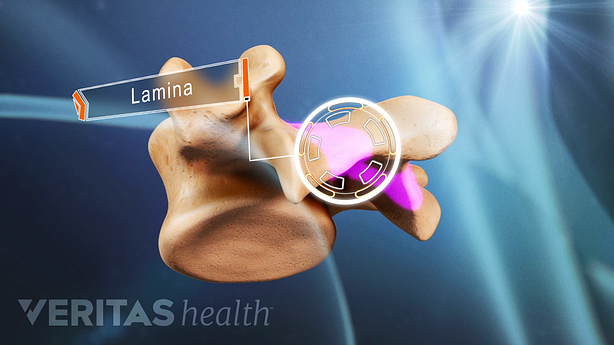 Isolated medical illustration of a vertebrae. The lamina is labeled.