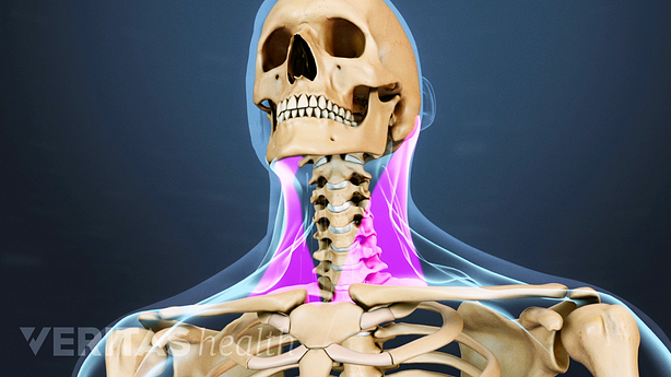 Medical illustration of the head and neck bone structures. Location muscles in the neck are highlighted