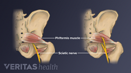Vista posterior de la parte inferior del cuerpo que muestra el nervio ciático y el músculo piriforme.