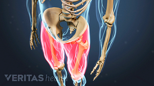 Medical illustration of the torso and upper legs. The thighs are highlighted in red to indicate pain