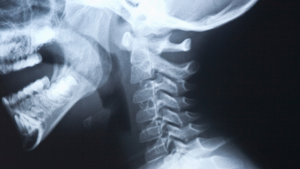 Illustration showing head and neck x-ray.