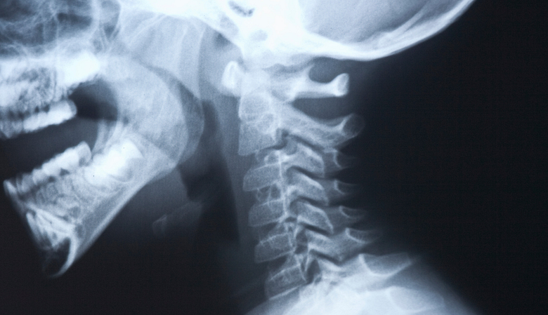 X-ray of head and neck.