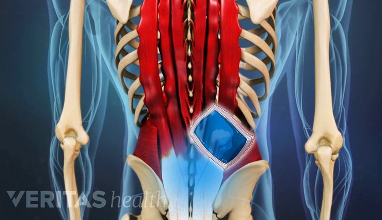 Illustration posterior view of lower back area, highlighted in blue and an icon of ice pack.