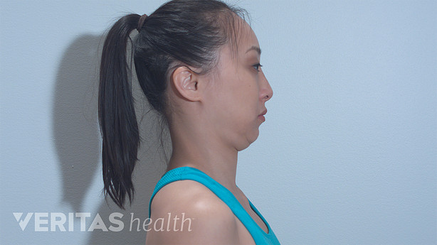 A woman performing the chin tuck exercise.