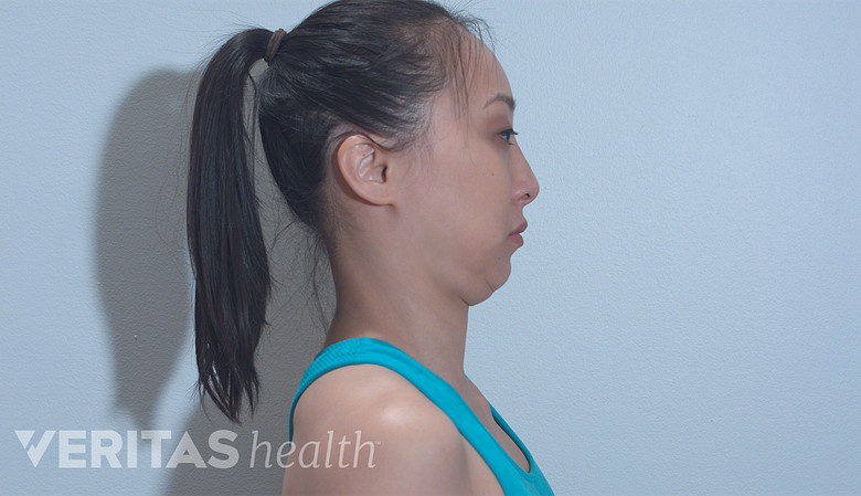 A woman performing chin tuck exercise.
