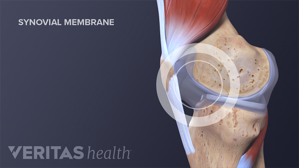 Illustration of synovial membrane in the knee