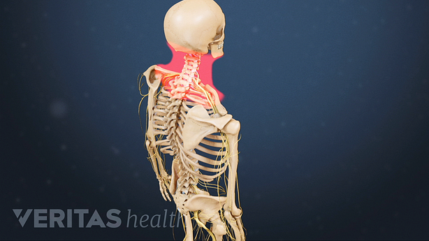 Illustration showing neck area highlighted in red.