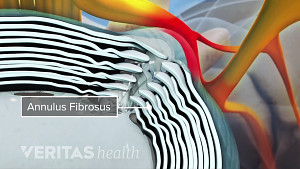 view of spinal disc labeling the annulus fibrosus