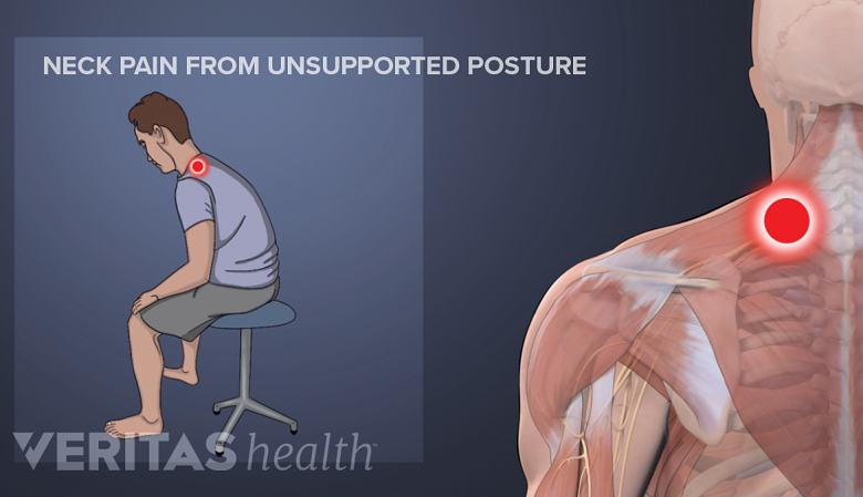 Illustration showing a man sitting in a bad posture with a red dot in the neck.
