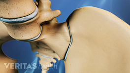 Vista anterior de la pelvis centrada en la articulación SI.