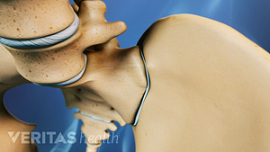 Vista anterior de la pelvis centrada en la articulación SI.