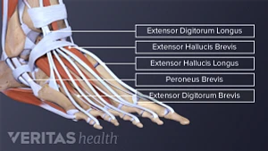 8 Ankle Sprain Exercises, Joint & Muscle Health