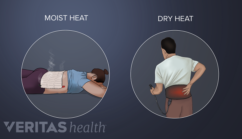 Understanding moist heat and dry heat.
