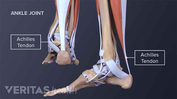 Medial and posterior view of an adult Achilles tendon