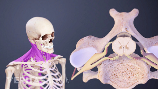 Medical illustration of a skeleton with the tendons and muscles in the neck highlighted. An inset shows a cross section of the cervical spinal cord