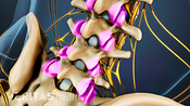 Anterior view of spondylosis in the facet joints of the lumbar spine.