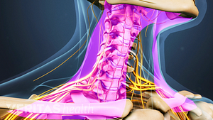Medical illustration of the cervical spine, nerves are shown, and muscles are highlighted in pink