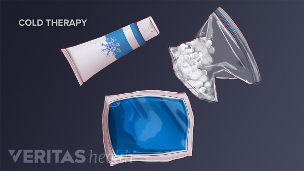 Illustration of 3 types of cold therapy items.